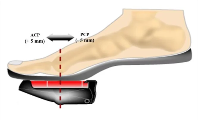 Cleat-Position: ACP (5 mm anterior) vs. PCP (5 mm posterior) – Ausrichtung am 1. Mittelfußknochenkopf